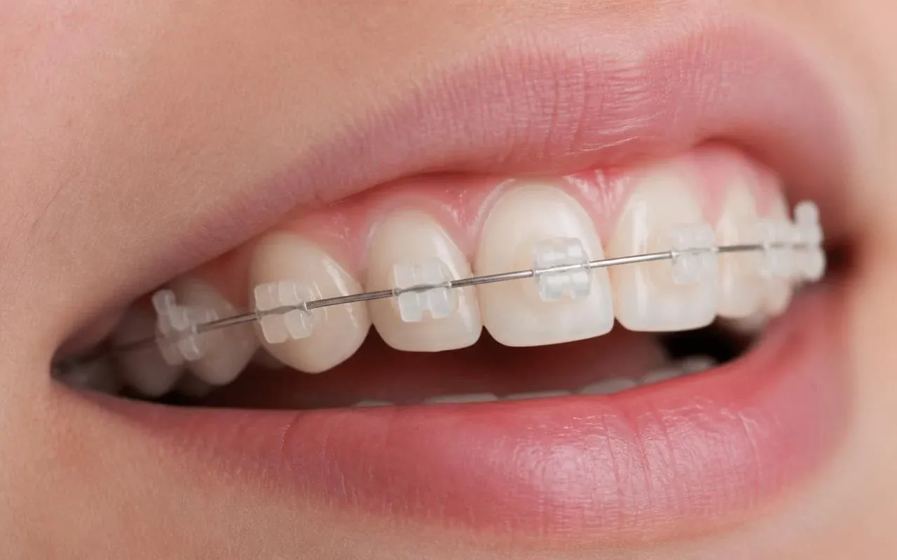 Стоматология туралы блог — Алматыдағы Dental-Center клиникасының фотографиясы
