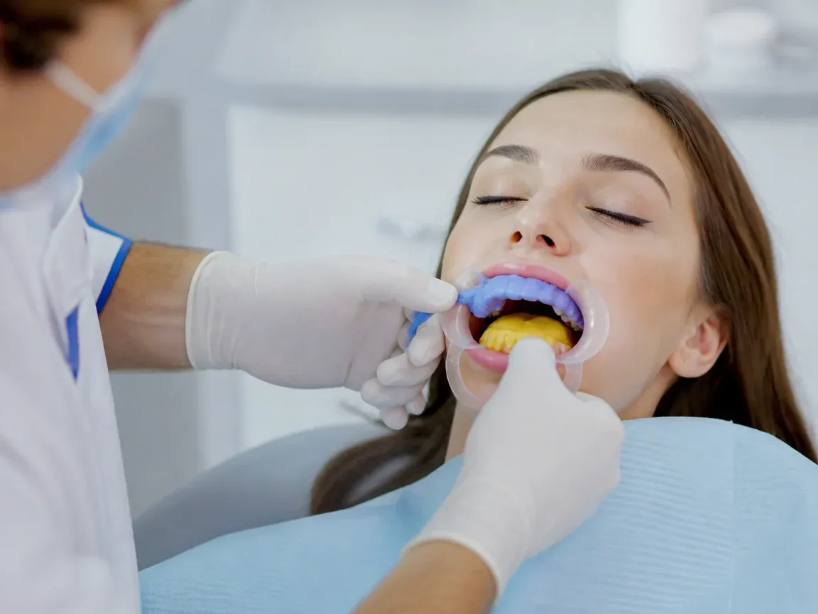 The treatment stage itself: the doctor's gloved hands working in the oral cavity — an illustration for the 'Impressions and Fitting' section