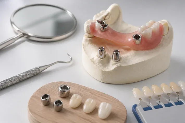 A jaw model and material samples on the dentist's table next to a mirror and probe — an illustration for the "Contraindications" section