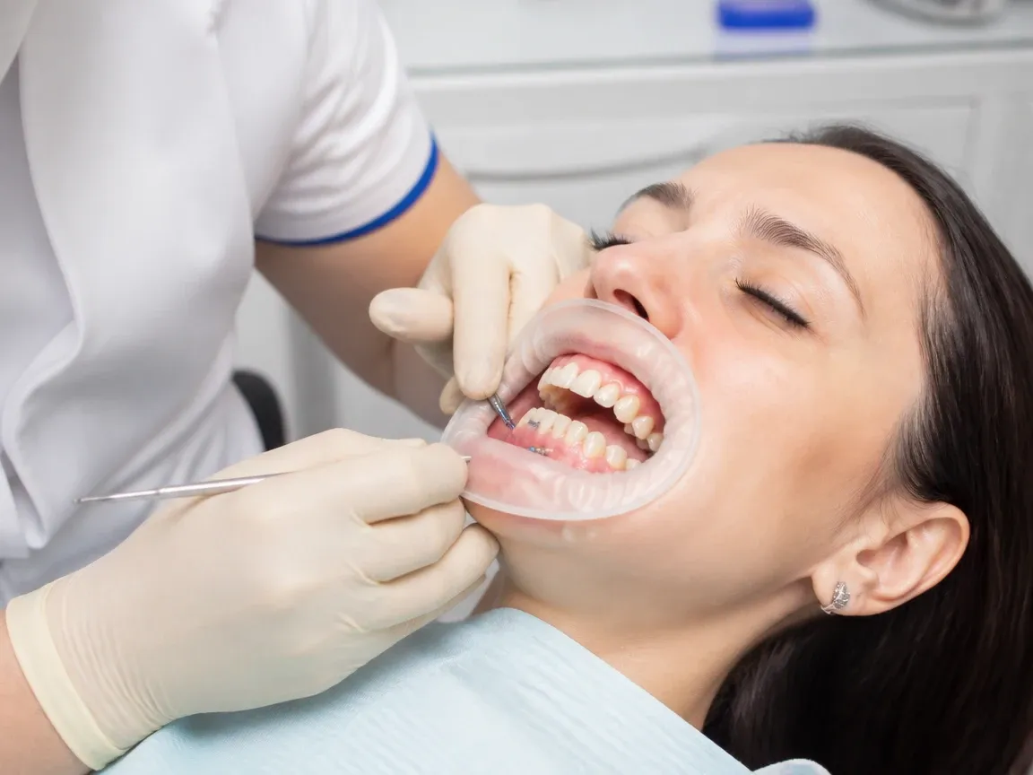 The treatment stage itself: the doctor's gloved hands working in the oral cavity — an illustration for the section "Osseointegration and the gum former"