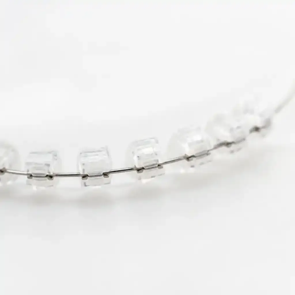 Plastic brackets on archwire