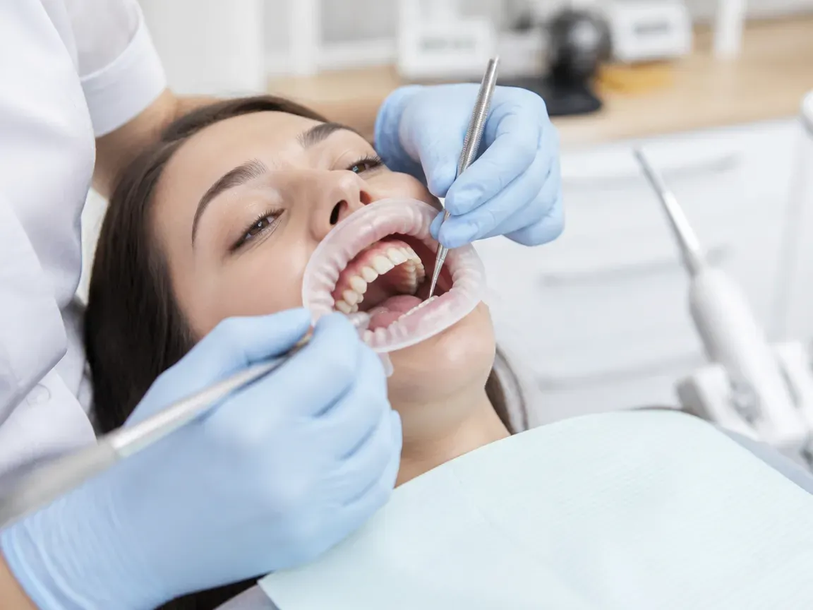 The treatment stage itself: the doctor's gloved hands working in the oral cavity — an illustration for the "Fitting" section