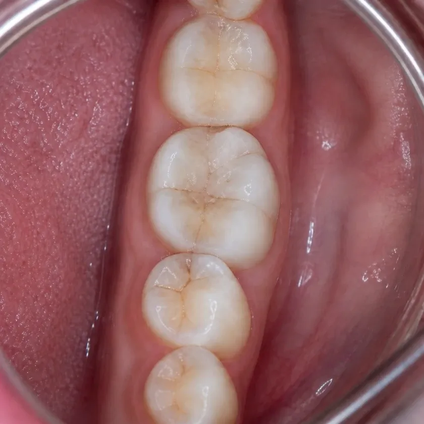 Dental treatment under general anesthesia — pre-treatment condition on a clinical image