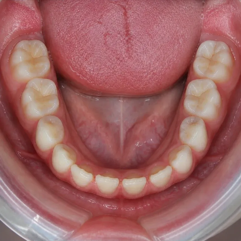 Dental treatment for children under sedation — pre-treatment condition on a clinical image