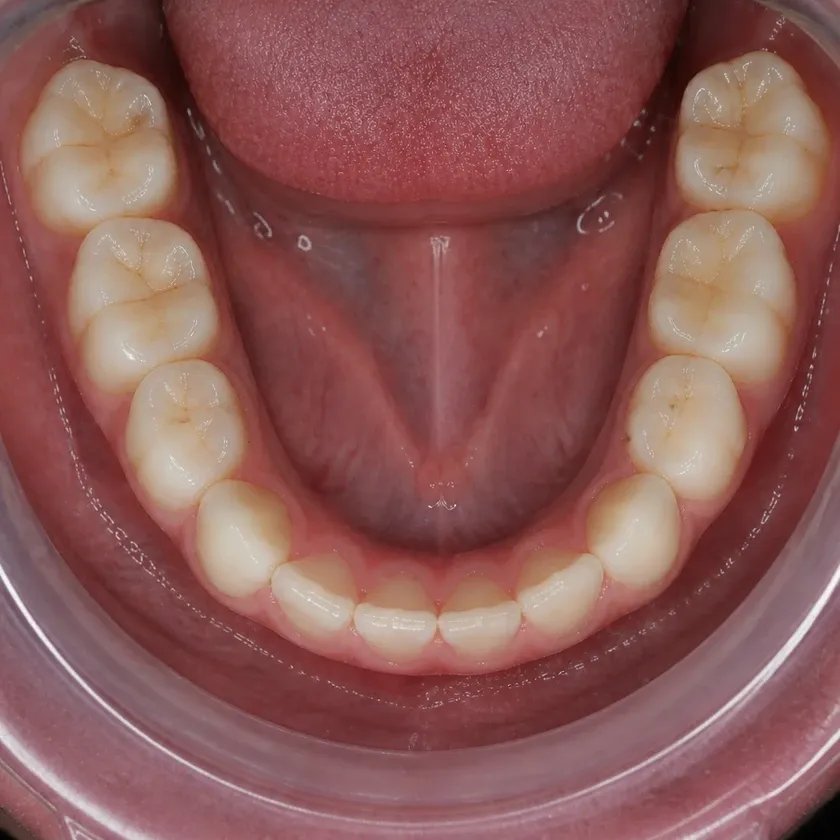 Dental treatment for children under sedation — pre-treatment condition on a clinical image