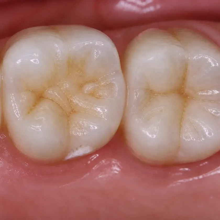 Dental treatment for children under sedation — pre-treatment condition on a clinical image