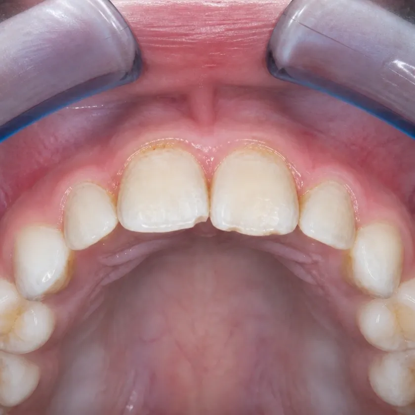 Dental treatment for children under sedation — pre-treatment condition on a clinical image