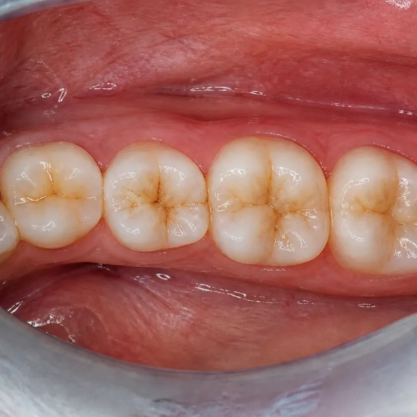 Dental treatment for children under sedation — pre-treatment condition on a clinical image