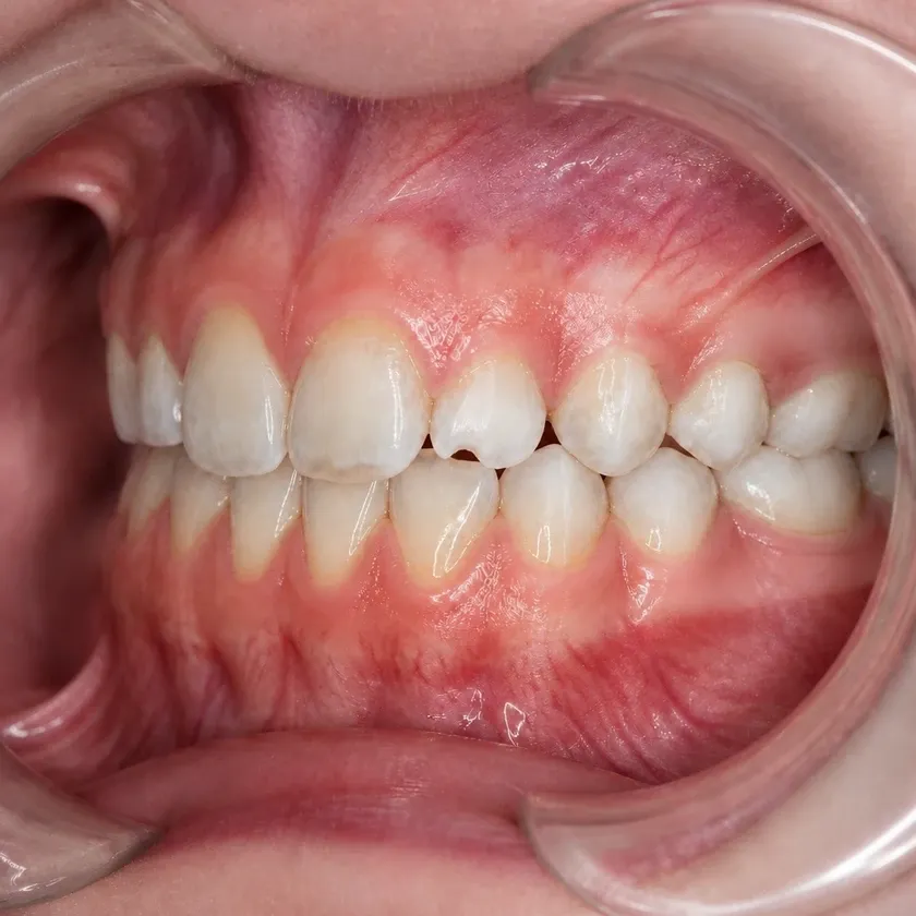 Dental treatment for children under sedation — pre-treatment condition on a clinical image