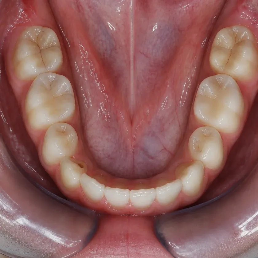 Dental treatment in children — pre-treatment condition on a clinical image