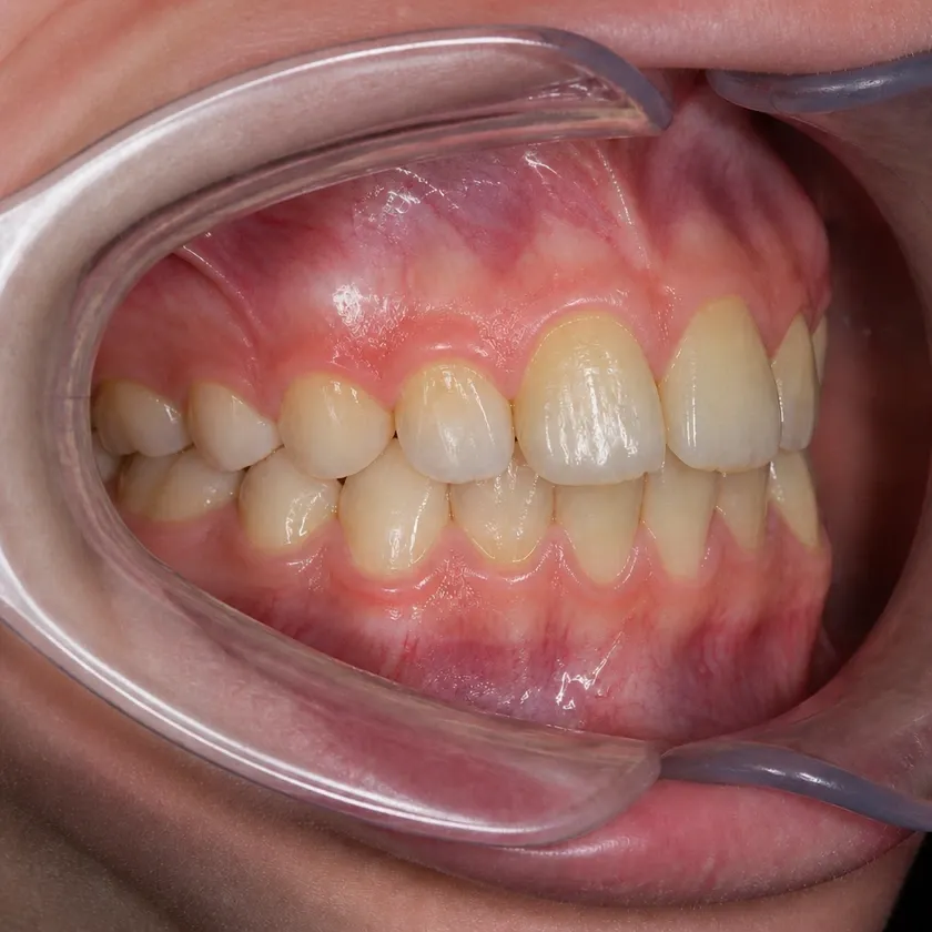Dental treatment in children — pre-treatment condition on a clinical image