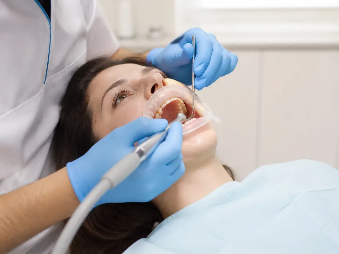 The treatment stage itself: the doctor's gloved hands working inside the oral cavity — an illustration for the "Layered restoration" section