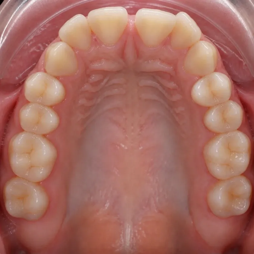 Orthodontics — pre-treatment condition in a clinical photograph