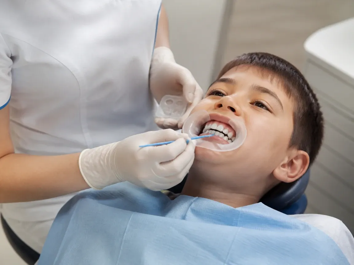 The treatment stage itself: the doctor's gloved hands working in the oral cavity — an illustration for the section "Application of the remineralizing agent"