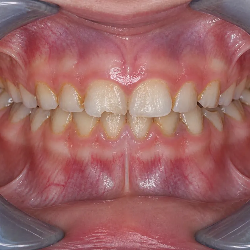 Dental treatment for children under sedation — pre-treatment condition on a clinical image