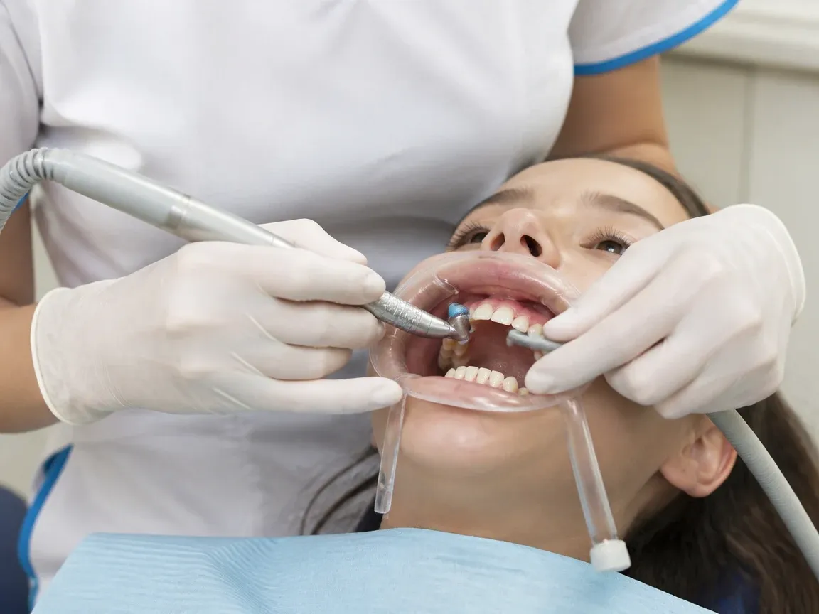 The treatment stage itself: the doctor's gloved hands working in the oral cavity — an illustration for the "Removing adhesive" section