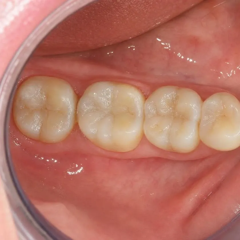 Тістеріңізді сақтайтын стоматология — Алматыдағы Dental-Center клиникасының фотографиясы