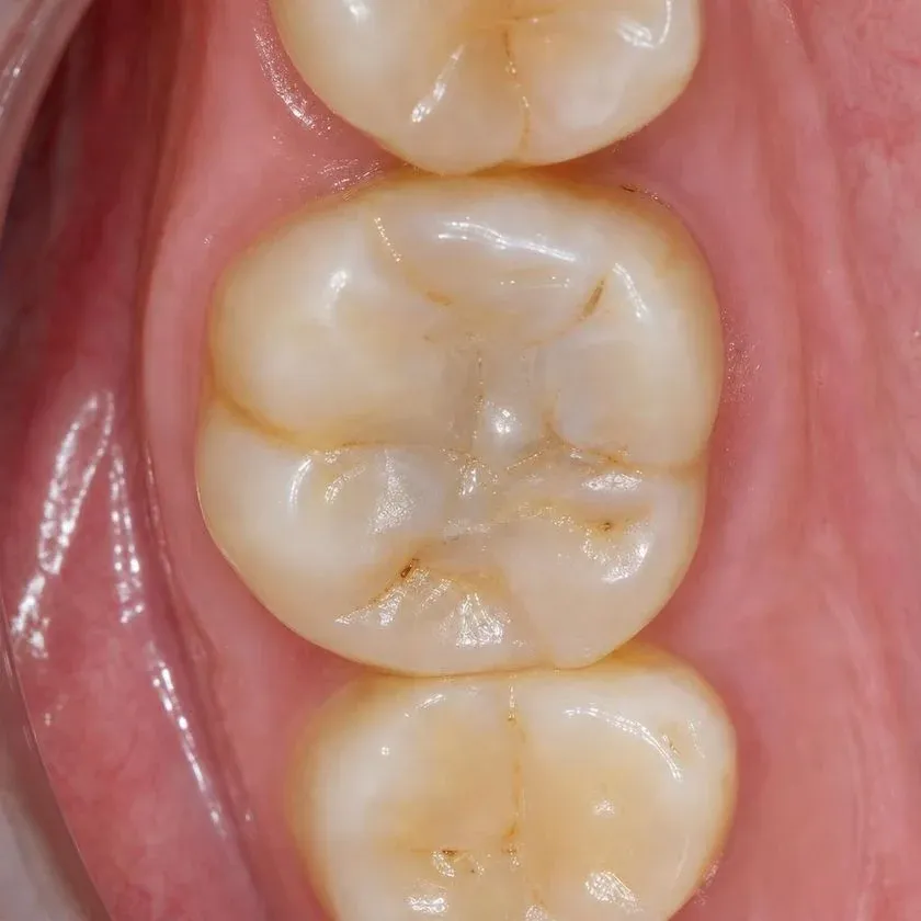 Тістеріңізді сақтайтын стоматология — Алматыдағы Dental-Center клиникасының фотографиясы