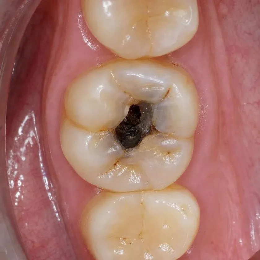 Тістеріңізді сақтайтын стоматология — Алматыдағы Dental-Center клиникасының фотографиясы
