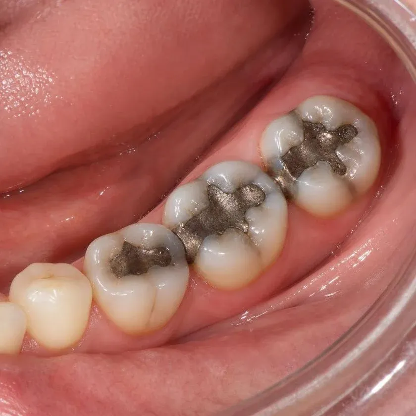 Тістеріңізді сақтайтын стоматология — Алматыдағы Dental-Center клиникасының фотографиясы