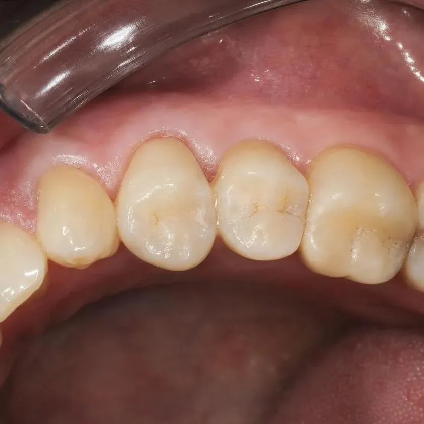 Тістеріңізді сақтайтын стоматология — Алматыдағы Dental-Center клиникасының фотографиясы
