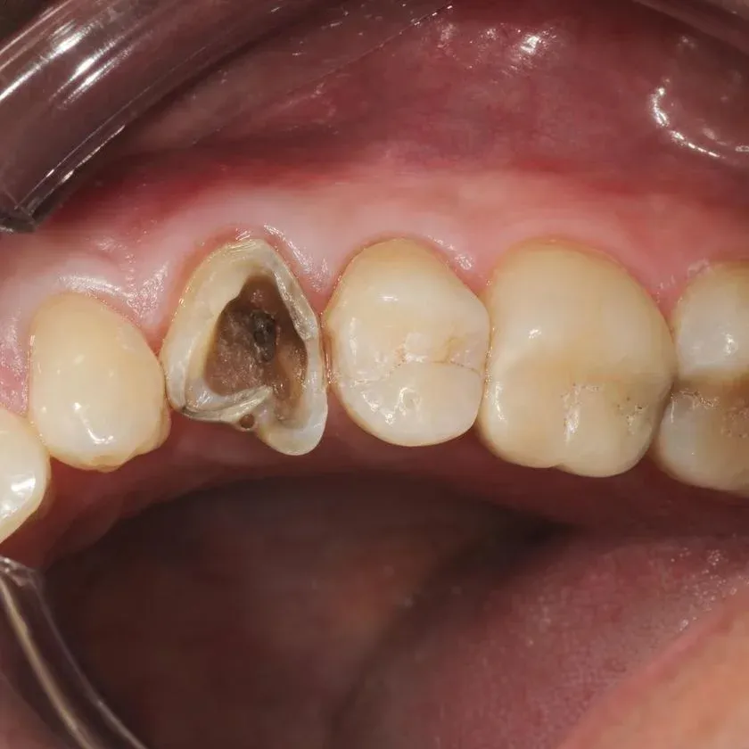 Тістеріңізді сақтайтын стоматология — Алматыдағы Dental-Center клиникасының фотографиясы