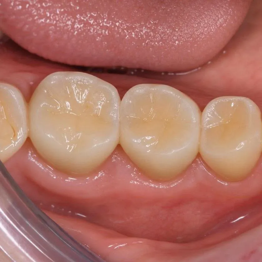 Тістеріңізді сақтайтын стоматология — Алматыдағы Dental-Center клиникасының фотографиясы