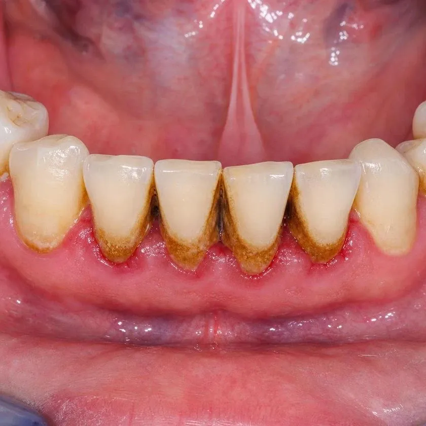 Тістеріңізді сақтайтын стоматология — Алматыдағы Dental-Center клиникасының фотографиясы