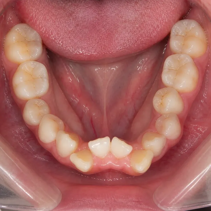 Dental trainers — pre-treatment condition on a clinical image