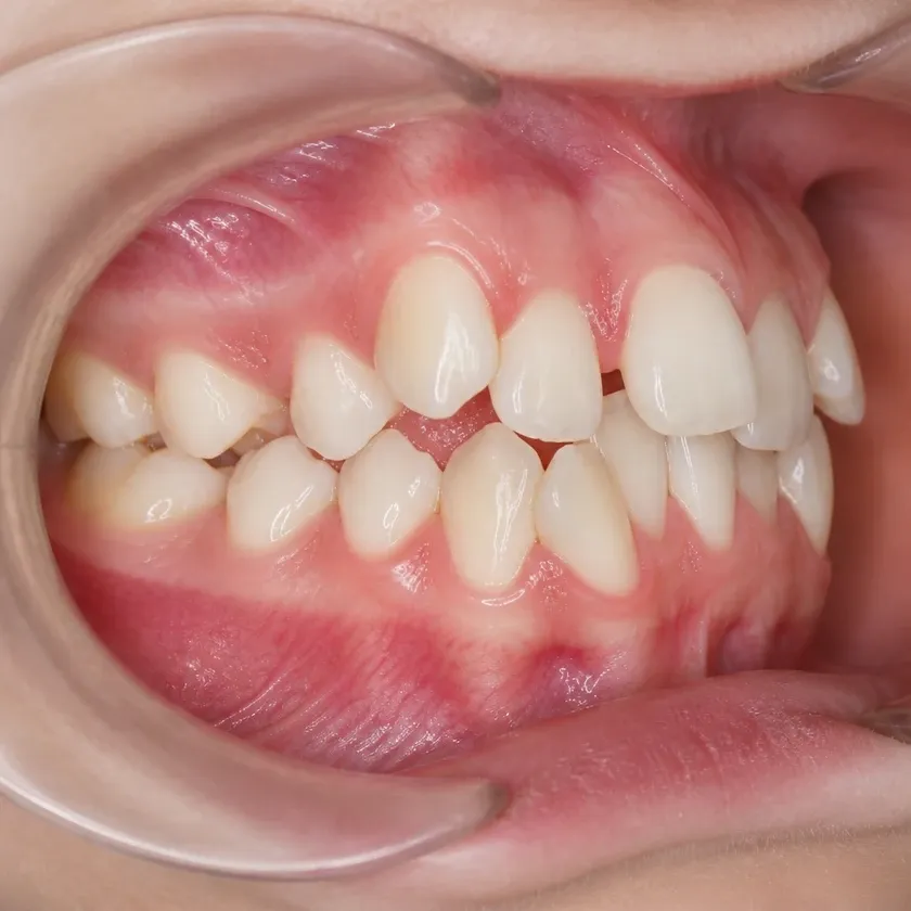 Dental trainers — pre-treatment condition on a clinical image