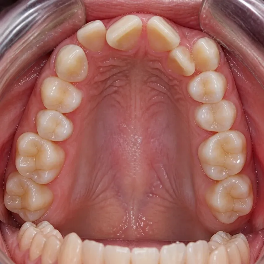 Dental trainers — pre-treatment condition on a clinical image