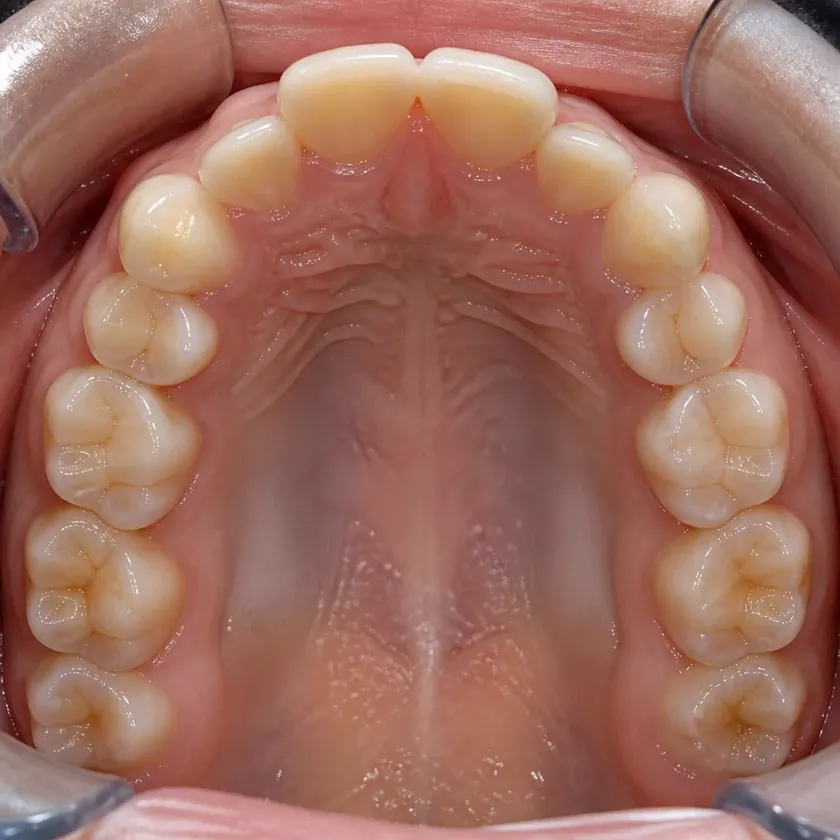 Children's dental trainers — post-treatment close-up on a clinical image