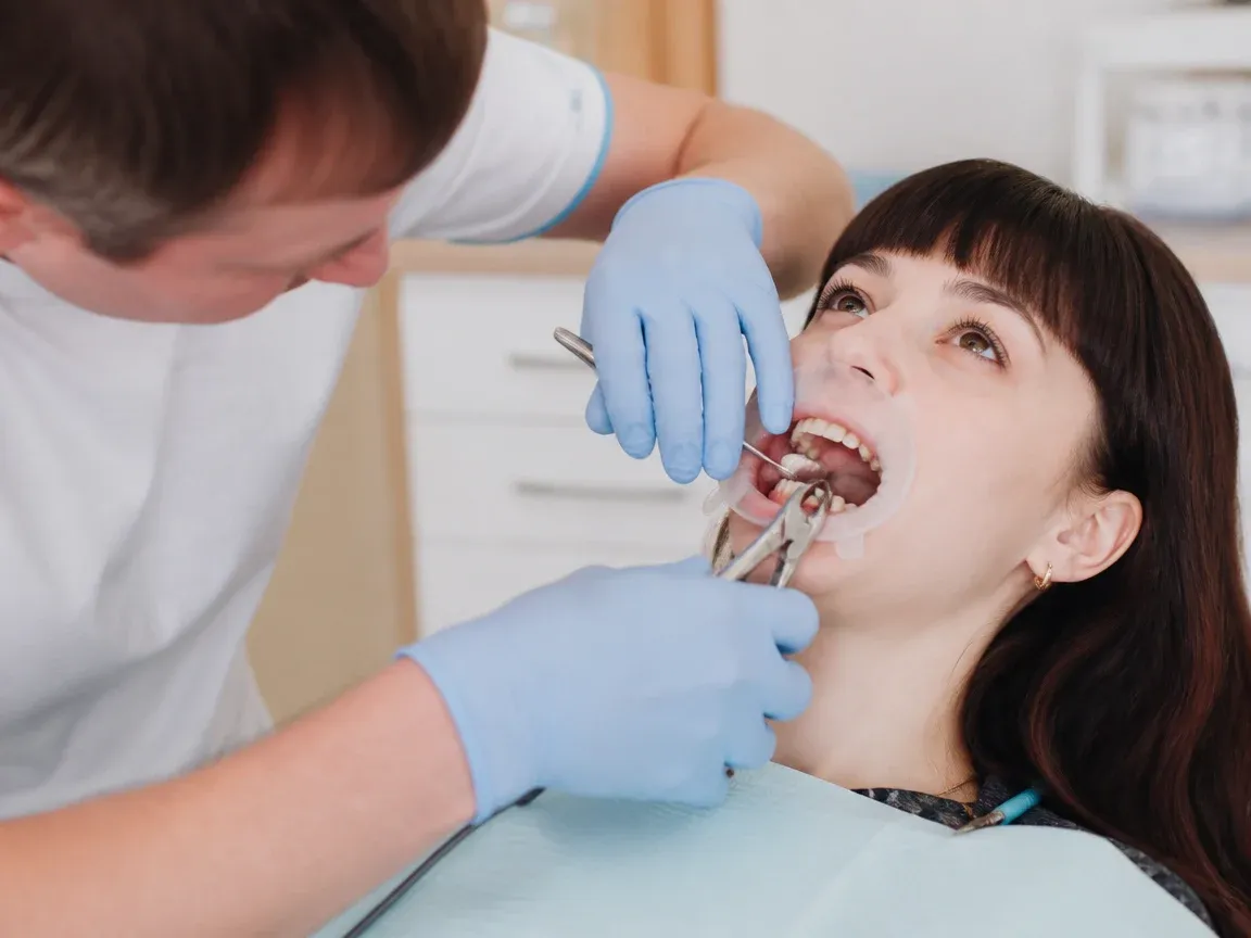 The treatment stage itself: the doctor's gloved hands working in the oral cavity — an illustration for the "Tooth Extraction" section