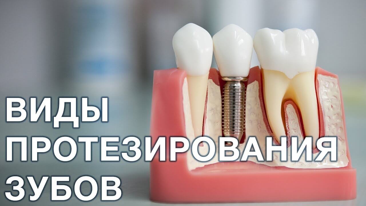 зубов протезирование
