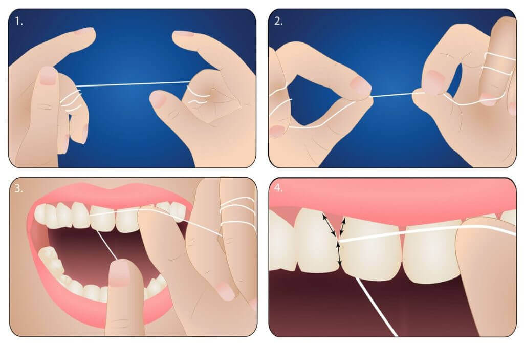 Разновидности нитей для зубов: как выбрать — Использование зубной нити, или флосса, — обязательный ритуал в ежедневной гигиене полости рта.